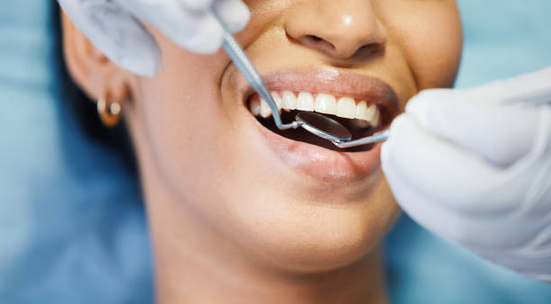 Best Broken Tooth Emergency  in Millington, NJ